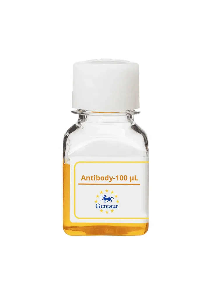 ALKBH3 Antibody  HRP conjugated   